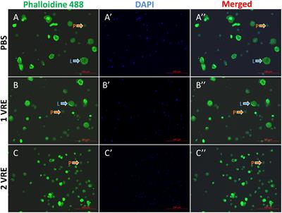 The Pupal Ectoparasitoid Pachycrepoideus vindemmiae Regulates Cellular and Humoral Immunity of Host Drosophila melanogaster